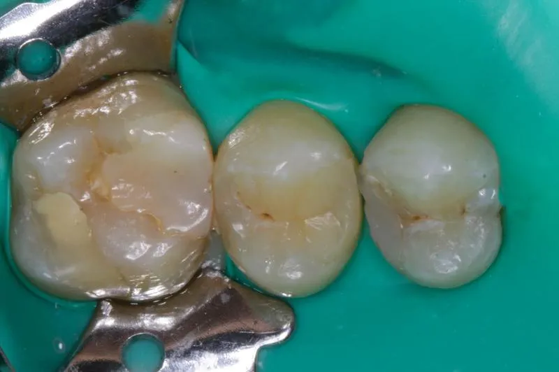 Budowa i anatomia zęba