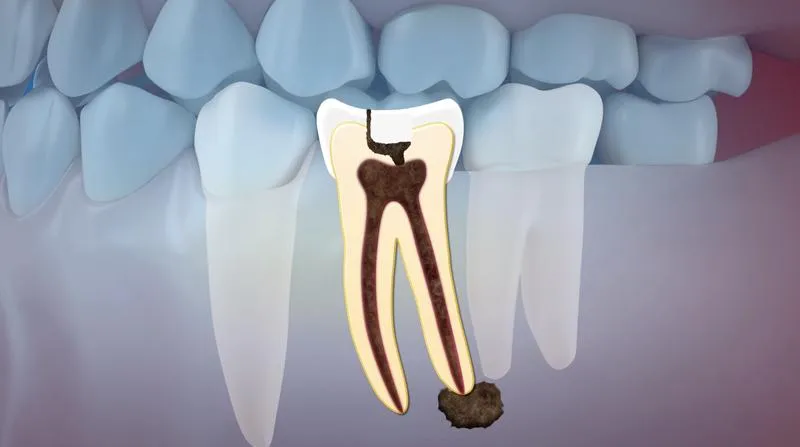 Proces formowania i rozwój zębów